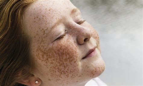 freckled mature|The Aging Skin: Why More Freckles May Appear With Age And .